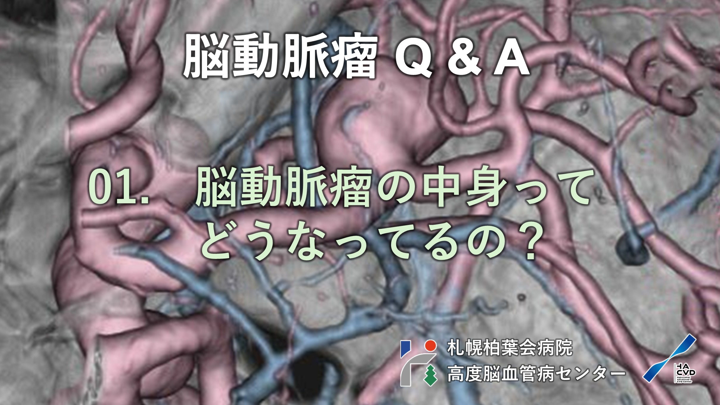 01. 脳動脈瘤の中身ってどうなっているの？